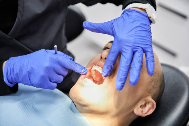Best Knocked-Out Tooth Emergency  in Highland Springs, VA